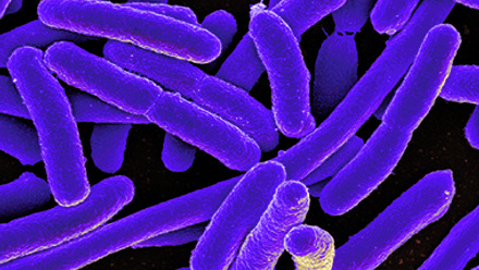 bacteria